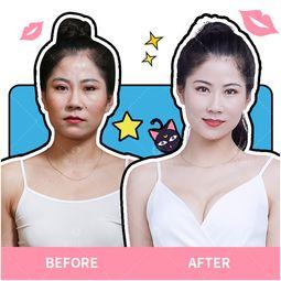 假体隆胸在线视频,在线视频带你了解全过程